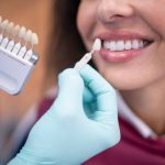 A Guide to the Durability and Maintenance of Cosmetic Dental Work